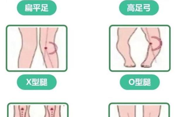 内八字和外八字