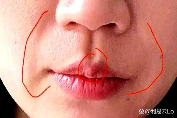 八字纹,八字纹是什么样子图片 八字纹,八字纹是什么样子图片