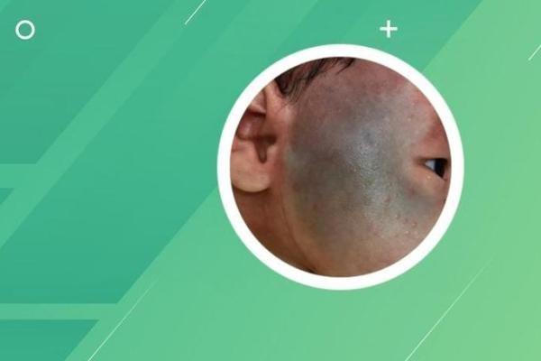 男婴眉心长“月牙”胎记,母亲带他算命后神秘失踪,至今下落不明 男婴眉心长“月牙”胎记,母亲带他算命后神秘失踪,至今下落不明