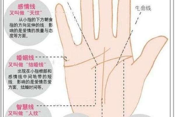 怎么看胎记算命-