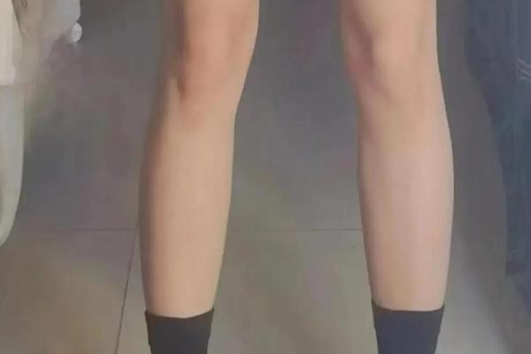 八字腿图片 八字腿图片