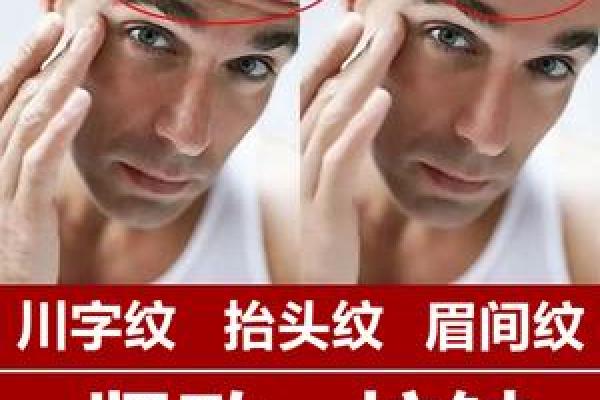 额头八字纹