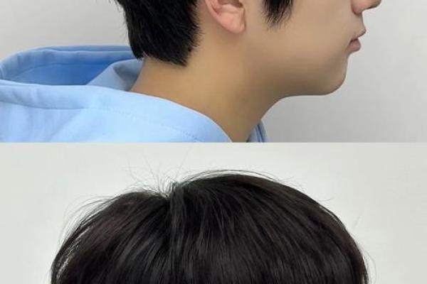 风水上后脑勺长痣代表什么意思