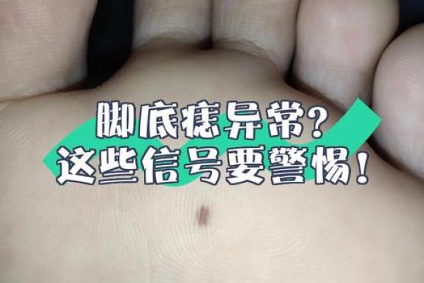 痣相风水脚底有痣的人命运好不好 痣相风水脚底有痣的人命运好不好