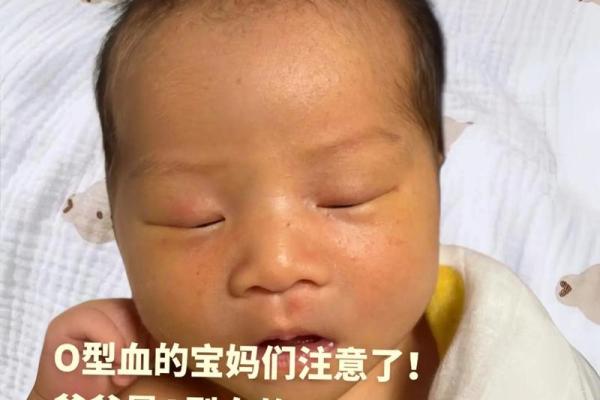 o型血是稀有血型吗 O型血稀有吗