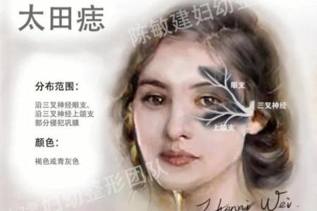 脸上胎记算命图解