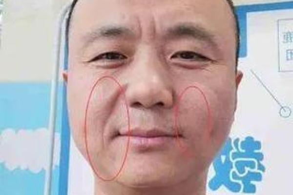 从法令纹看相算命