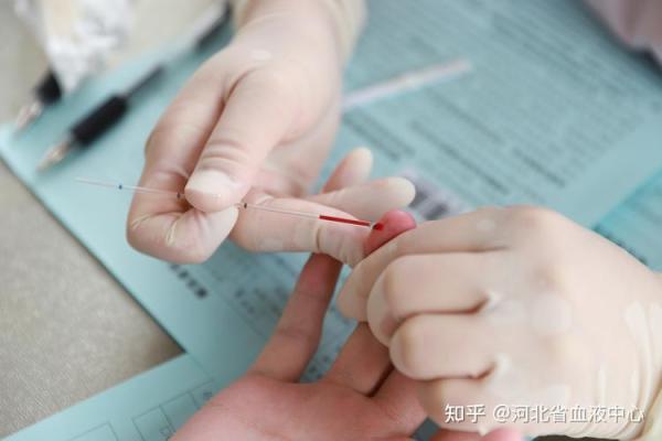 自我改造与血型解析