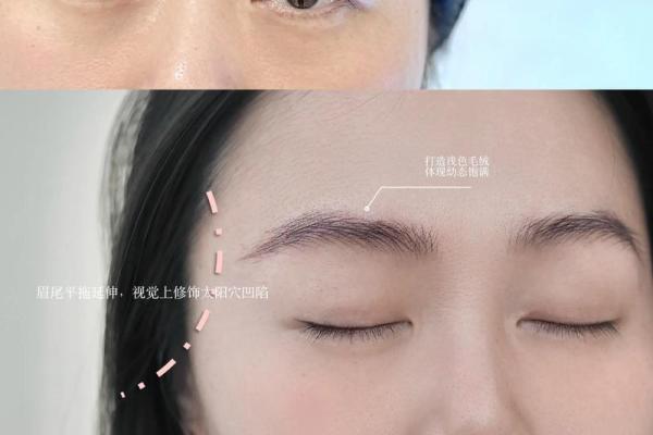 眉头有八字印预示什么？如何化解眉头八字印带来的影响？