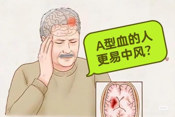 血型决定寿命长短？美国60万人研究发现：A型血60岁前或更易中风