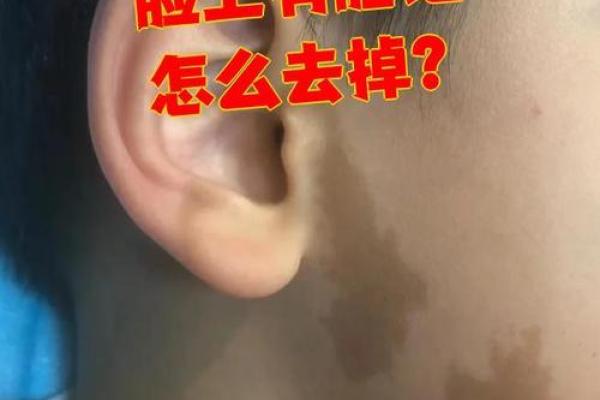 看胎记颜色类型算命