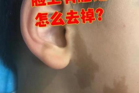 看胎记颜色类型算命