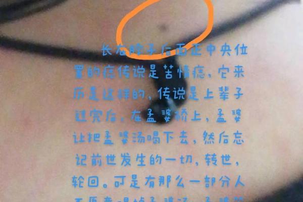 脖子上不同位置胎记算命