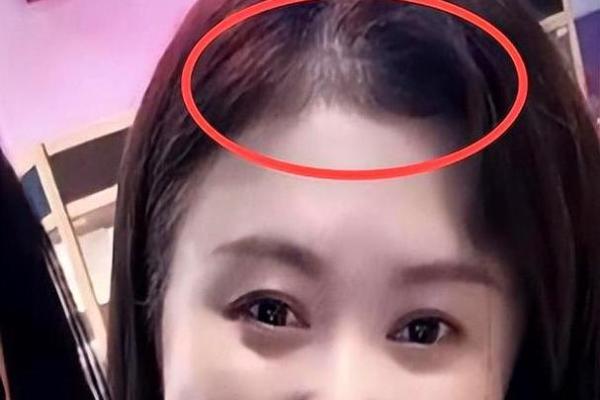 头发稀少的八字特征 八字头发稀少