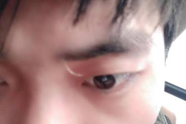 脸上长白毛的算命说法 脸上有白毛的人能算命吗 脸上长白毛的算命说法 脸上有白毛的人能算命吗