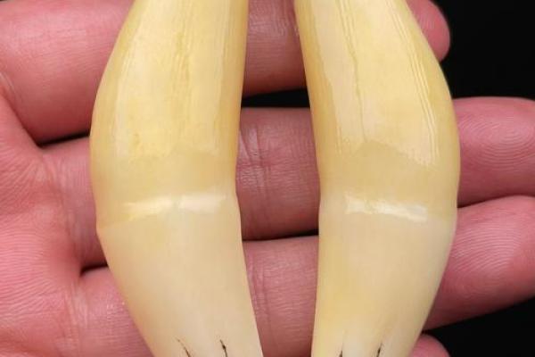 虎牙算命：面相虎牙分析